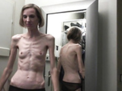 anorexic Sonja 2