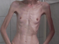 anorexic Sonja shower 8t00354