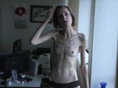 anorexic Sonja 8t00350