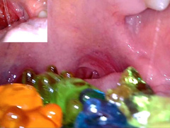 Vore- gummy bears endoscopy